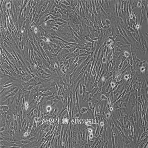 人包皮成纤维细胞,HSF(SV40)