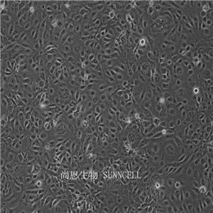 人微血管内皮细胞,HMEC-1