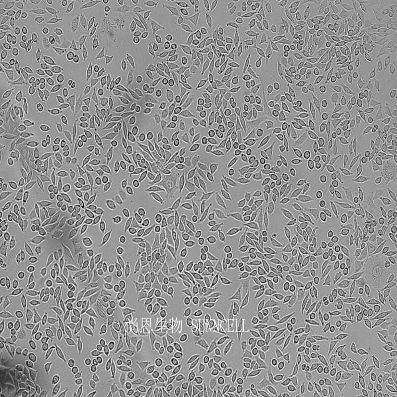 小鼠成纤维细胞,NCTC clone 929 [L cell, L-929