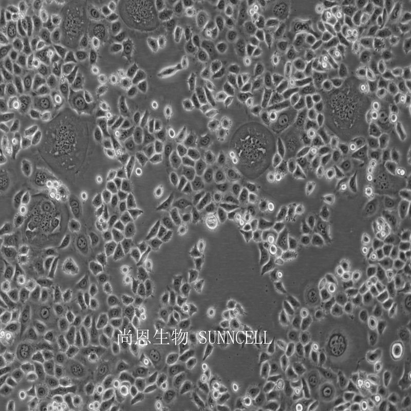 人子宫颈表皮癌细胞,ME-180
