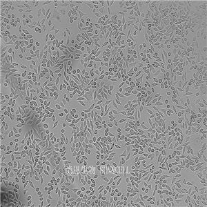 小鼠成纤维细胞,NCTC clone 929 [L cell, L-929