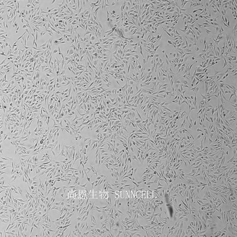 小鼠淋巴结内皮细胞,SVEC4-10