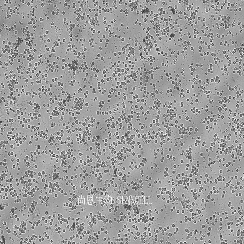 人急性原粒细胞白血病细胞,Kasumi-1
