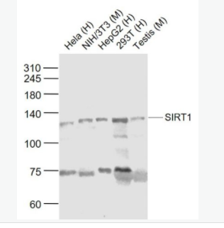 SIRT1 沉默調(diào)節(jié)蛋白1抗體,SIRT1