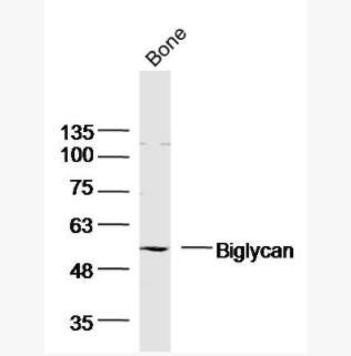 Biglycan 骨/軟骨蛋白多糖1抗體,Biglycan