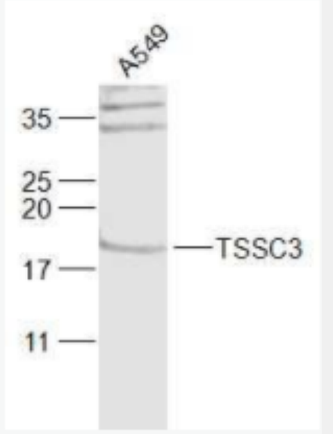 TSSC3 腫瘤抑制轉(zhuǎn)移候選基因3抗體,TSSC3