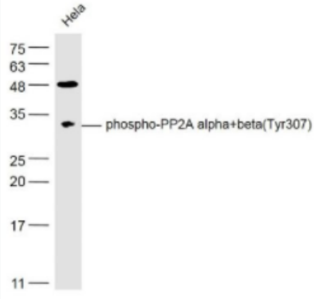 phospho-PP2A alpha+beta (Tyr307) 磷酸化蛋白磷酸酶2A（PP2Aα）抗体,phospho-PP2A alpha+beta (Tyr307)