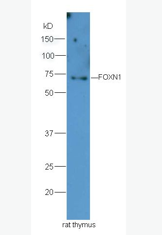 FOXN1 叉頭蛋白N1抗體,FOXN1