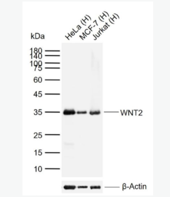 WNT2 信号通路Wnt2抗体,WNT2