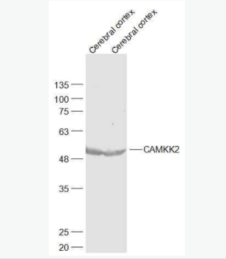 CAMKK2 钙调蛋白激酶激酶β抗体,CAMKK2