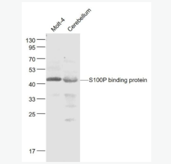 S100P binding proteinS100P結(jié)合蛋白抗體,S100P binding protein