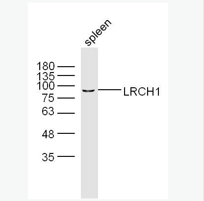 LRCH1 富含亮氨酸重复家庭蛋白1抗体,LRCH1