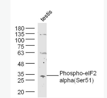 Phospho-EIF2S1 (Ser51)磷酸化真核啟動因子2α抗體,Phospho-EIF2S1 (Ser51)