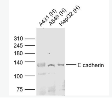 E cadherin 上皮钙粘附分子抗体,E cadherin