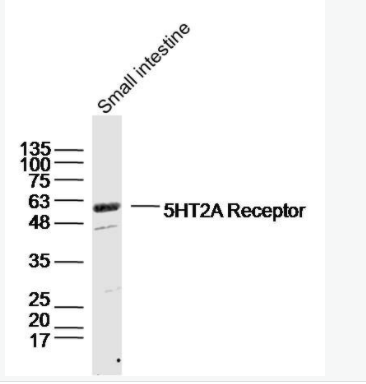 5HT2A Receptor 5-羟色胺受体2A抗体,5HT2A Receptor