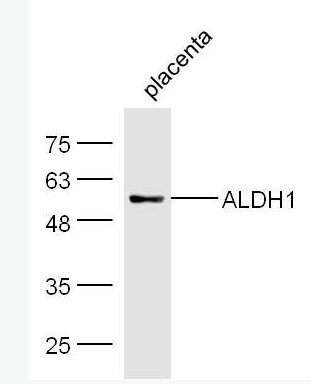 ALDH1A1 乙醛脱氢酶1型抗体,ALDH1A1