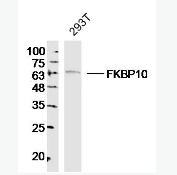 FKBP10 肽基脯氨酰顺反异构酶FKBP10抗体,FKBP10