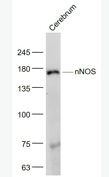 nNOS 一氧化氮合成酶-1（神经型）抗体,nNOS
