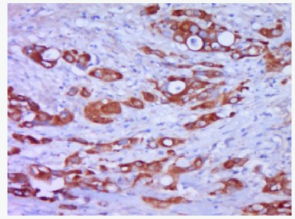 Cytokeratin 19 细胞角蛋白19片段(CYFR21-1)抗体,Cytokeratin 19