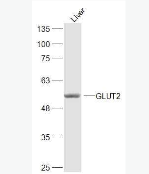 GLUT2 葡萄糖转运蛋白2抗体,GLUT2