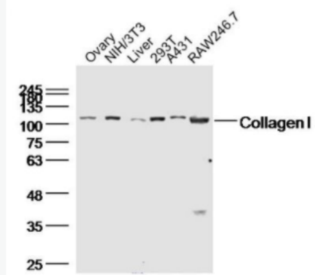 Collagen I I型胶原蛋白/胶原蛋白1/1型胶原蛋白/I型胶原a1抗体,Collagen I