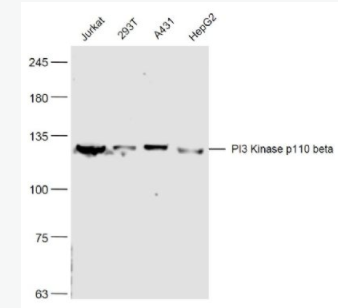 PI3 Kinase p110 beta 磷脂酰肌醇激酶（PI3Kβ）抗体,PI3 Kinase p110 beta