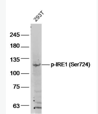 phospho-IRE1 (Ser724) 磷酸化IRE1蛋白抗体,phospho-IRE1 (Ser724)