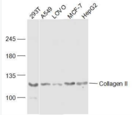 Collagen II Ⅱ型胶原蛋白抗体,Collagen II
