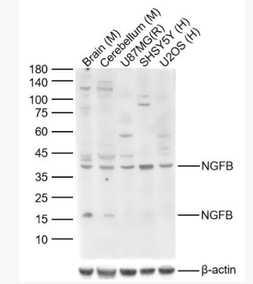 NGFB 神经生长因子β抗体,NGFB