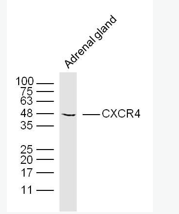 CXCR4 細(xì)胞表面趨化因子受體4抗體,CXCR4