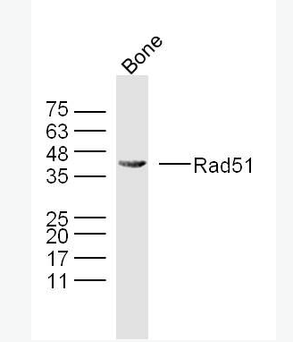 Rad51 Rad51抗体,Rad51