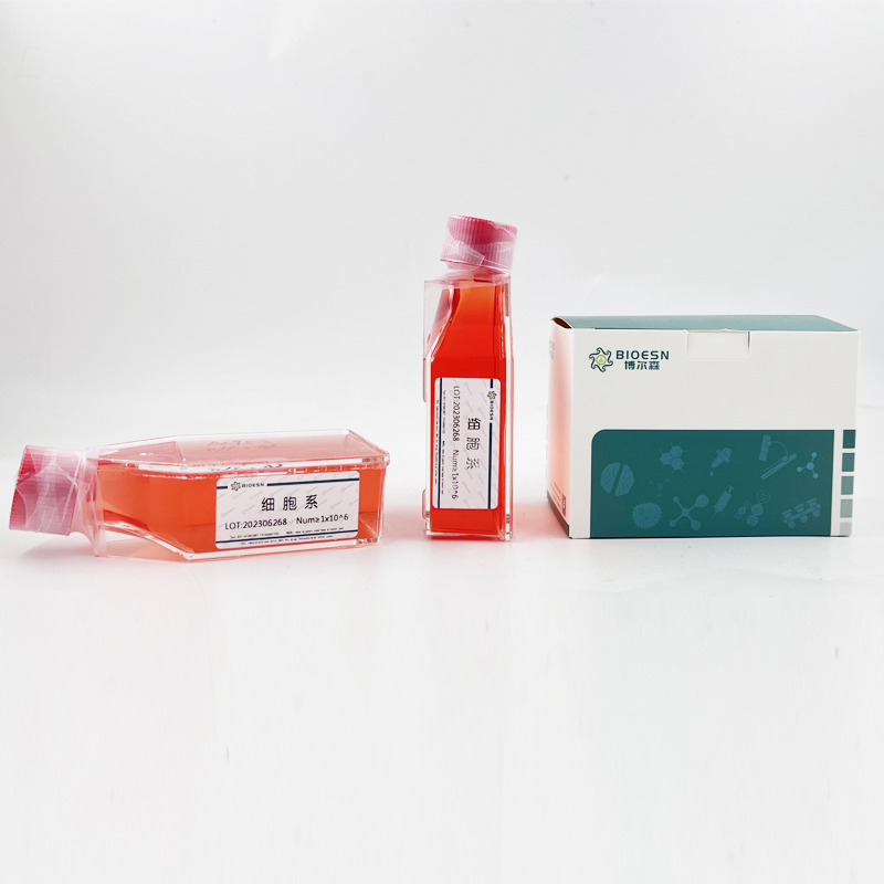 小鼠甲状腺结合球蛋白(TBG) ELISA Kit,TBG ELISA Kit