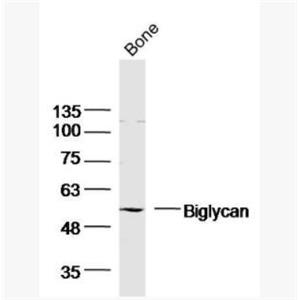 Biglycan 骨/軟骨蛋白多糖1抗體,Biglycan