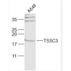 TSSC3 腫瘤抑制轉(zhuǎn)移候選基因3抗體