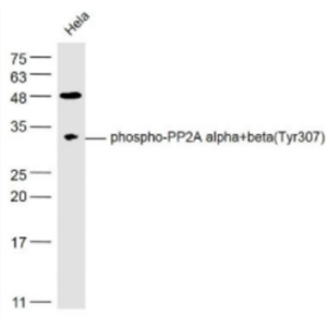 phospho-PP2A alpha+beta (Tyr307) 磷酸化蛋白磷酸酶2A（PP2Aα）抗体,phospho-PP2A alpha+beta (Tyr307)