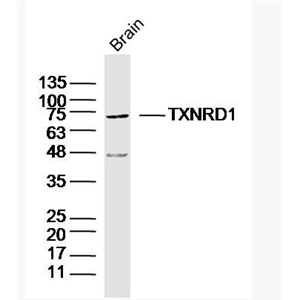 TXNRD1 硫氧环蛋白还原酶1抗体