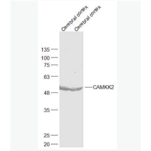 CAMKK2 钙调蛋白激酶激酶β抗体,CAMKK2