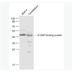 S100P binding protein S100P结合蛋白抗体