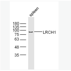 LRCH1 富含亮氨酸重复家庭蛋白1抗体