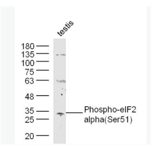 Phospho-EIF2S1 (Ser51) 磷酸化真核启动因子2α抗体