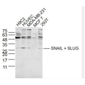 SNAIL + SLUG 锌指转录因子Slug+SNAIL抗体