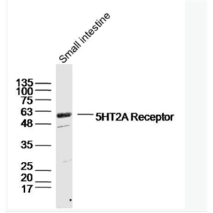 5HT2A Receptor  5-羟色胺受体2A抗体