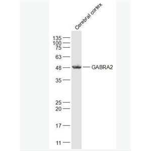 GABRA2 G氨基丁酸A型受體α2/GABAA Rα2抗體