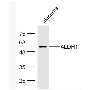 ALDH1A1 乙醛脱氢酶1型抗体