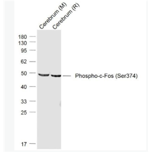 Phospho-c-Fos (Ser374) 磷酸化c-fos抗体