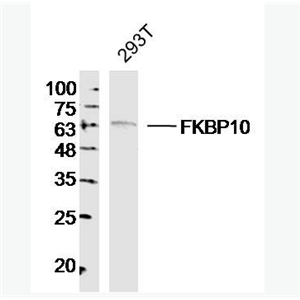 FKBP10 肽基脯氨酰顺反异构酶FKBP10抗体