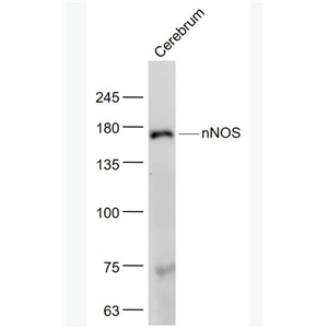 nNOS 一氧化氮合成酶-1（神经型）抗体