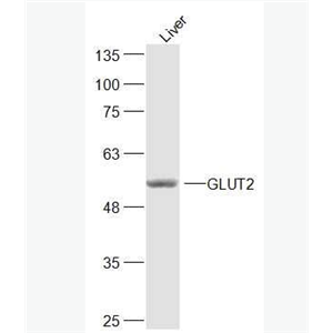 GLUT2 葡萄糖转运蛋白2抗体,GLUT2