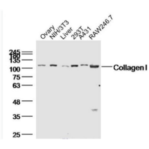 Collagen I I型胶原蛋白/胶原蛋白1/1型胶原蛋白/I型胶原a1抗体