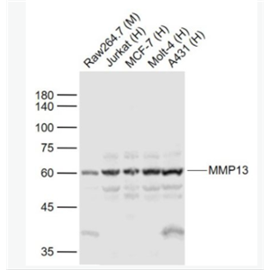 MMP13 基质金属蛋白酶13抗体,MMP13